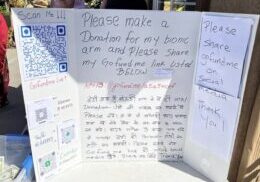 Person with donation board seeking bionic arm